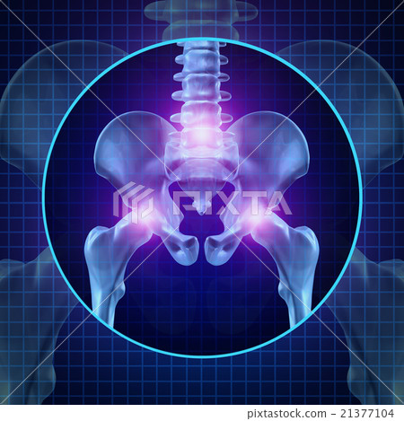 Stock Illustration: Back Joint Pain