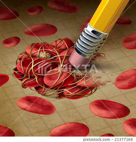 Blood Clot Treatment 21377168