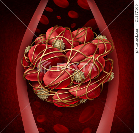 Blood Clot Blood Clot 21377169