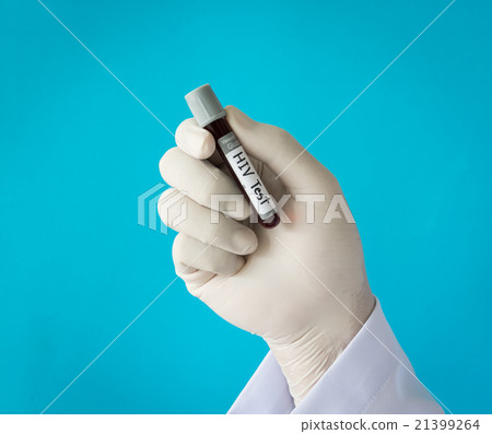 blood test 21399264