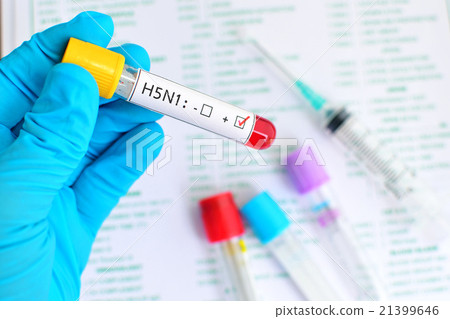 H5N1 influenza virus test 21399646