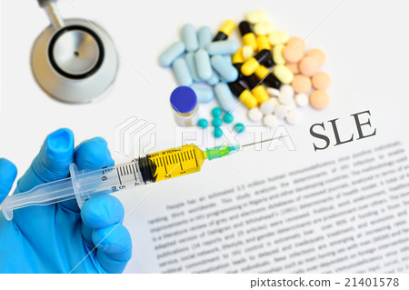Systemic lupus erythematosus (SLE) 21401578