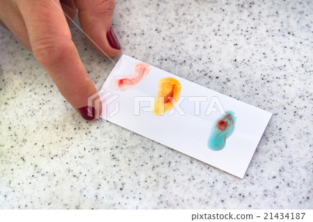 Blood type testing. 21434187