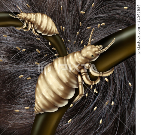 Lice In Hair 21545684