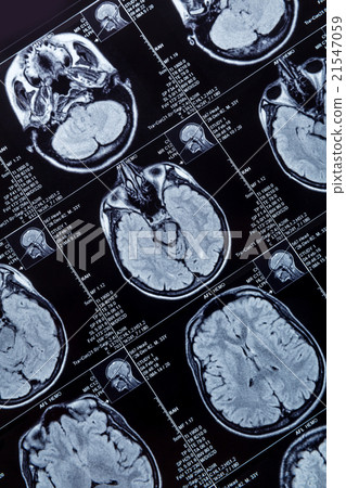 Magnetic resonance imaging 21547059