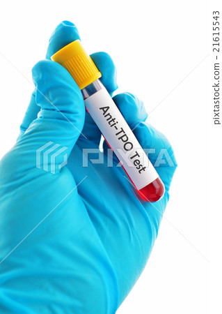 Anti-TPO (Anti-thyroid peroxidase) test 21615543