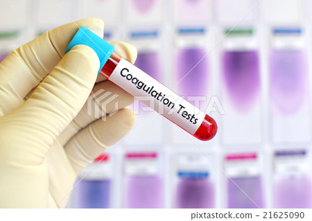 Blood coagulation test Blood coagulation test 21625090
