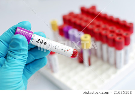 Zika virus test 21625198