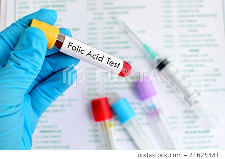 Folic test Folic test 21625381