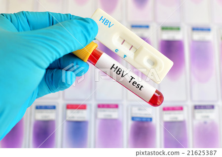 Hepatitis B virus test 21625387