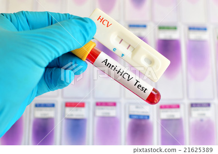 Hepatitis C virus test 21625389
