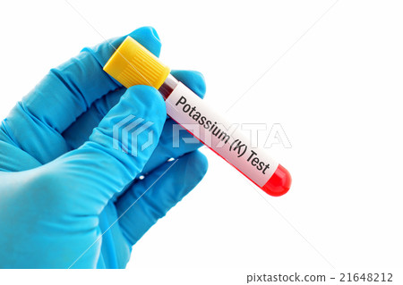 Potassium (K) test 21648212