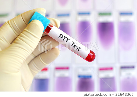 Partial thromboplastin time (PTT) test 21648365