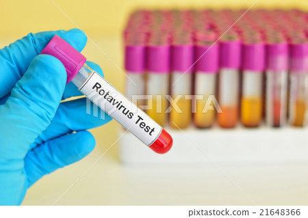 Rotavirus test 21648366