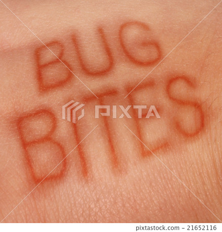 Bug Bites 21652116
