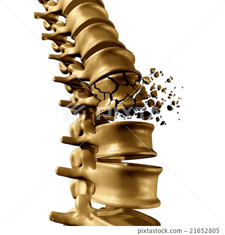 Spine Fracture 21652805