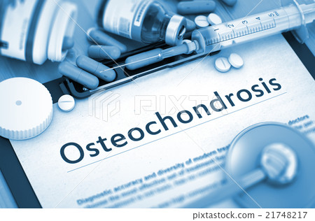 Osteochondrosis Diagnosis. Medical Concept. Osteochondrosis Diagnosis. Medical Concept. 21748217
