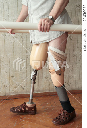 Prosthesis Prosthesis 21836685