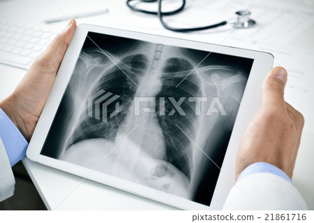 doctor observing a chest radiograph in a tablet 21861716
