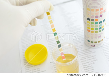 Urine analysis 21946998