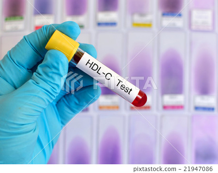 HDL cholesterol test 21947086