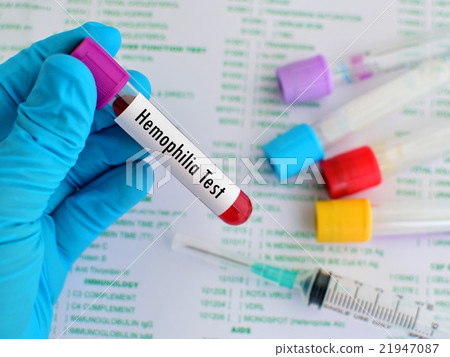 Hemophilia test Hemophilia test 21947087