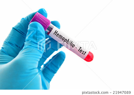 Hemophilia test Hemophilia test 21947089