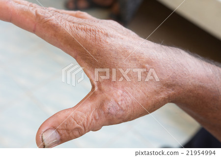 Skin disorder Skin disorder 21954994