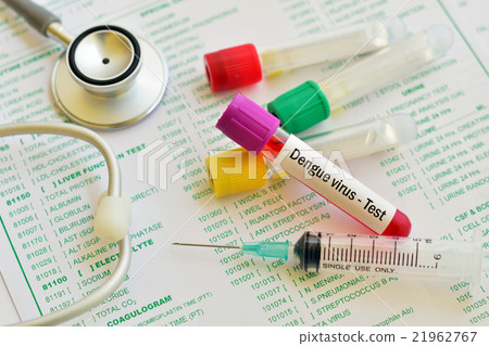 Dengue virus test 21962767