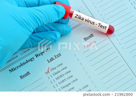 Zika virus positive 21962800