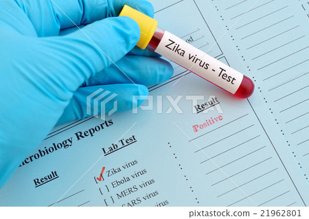 Zika virus positive 21962801