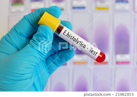E.histolytica test 21962853