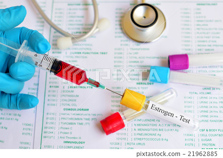 Estrogen hormone test 21962885