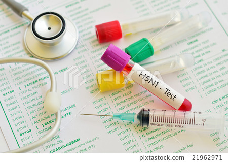 H5N1 influenza virus test 21962971