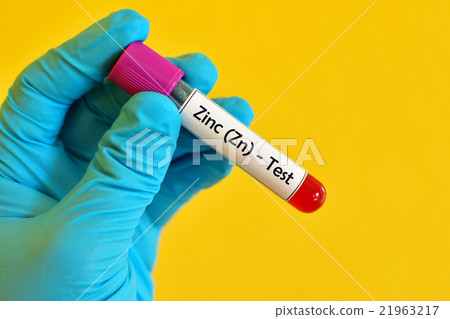 Zinc test 21963217