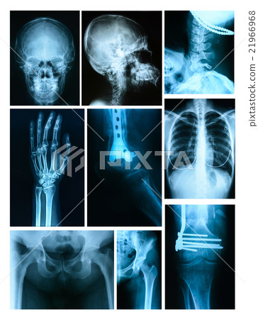 Collage of many X-rays. Very good quality 21966968