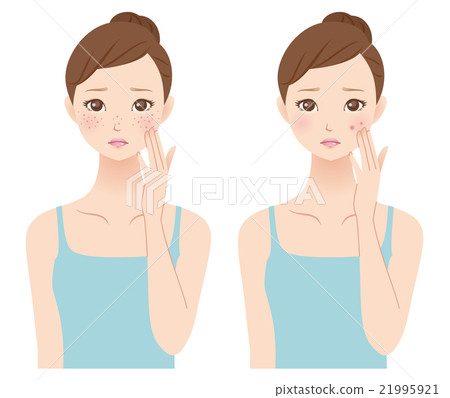 Women suffering from skin problems beauty skin care 21995921