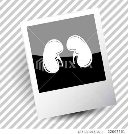 kidneys. 22008561