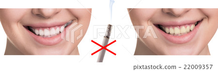 Smile before and after smoking. Smile before and after smoking. 22009357