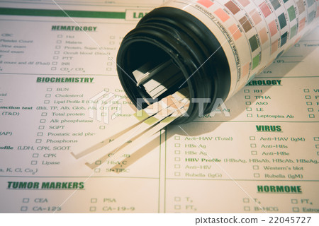 Urine examination test in laboratory. 22045727