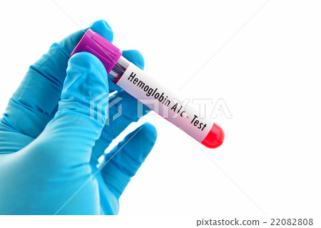 Hemoglobin A1c (HbA1c) test for diabetes diagnosis 22082808