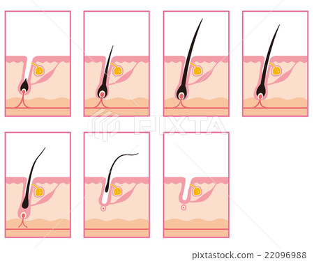 Hair Removal Hair Cycle Hair Cycle 22096988