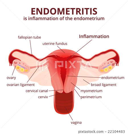 female reproductive system 22104483