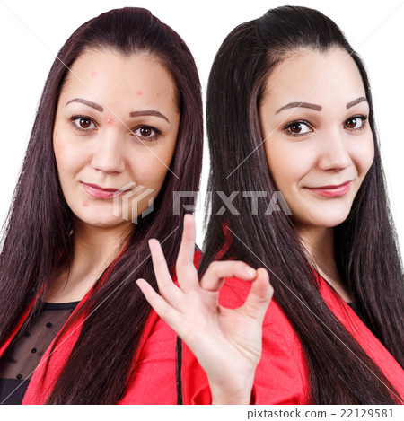 Woman with problem skin on her face Woman with problem skin on her face 22129581