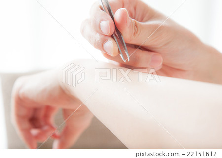 脫髮，手臂，鑷子，鑷子，女性 22151612