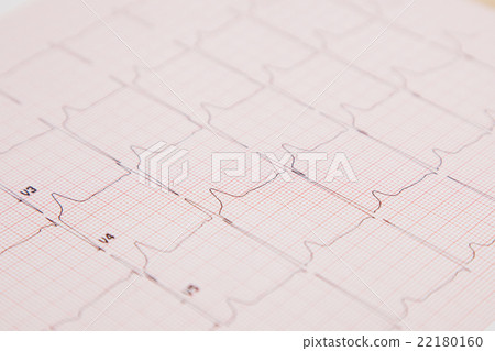 Medical report and cardiogram Medical report and cardiogram 22180160
