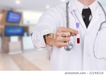 close up a medical test glass with blood 22249210