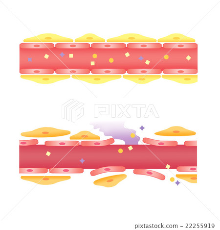 Anti-aging of blood vessels Young blood vessels... - Stock Illustration ...