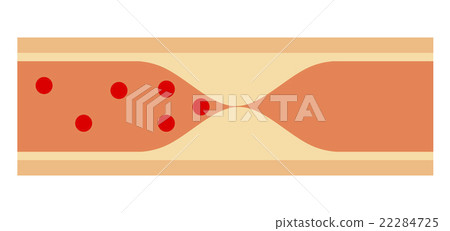 Atherothrombosis Atherothrombosis 22284725