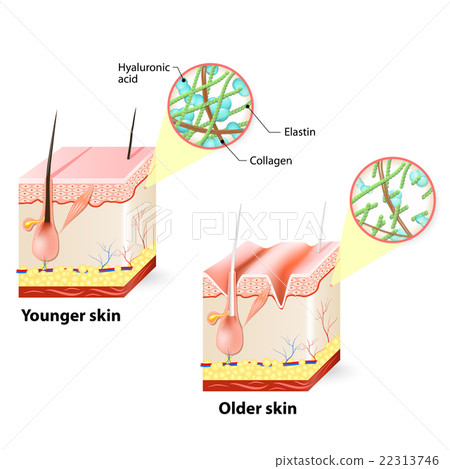 skin aging 22313746